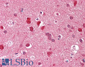 Anti-ZFYVE1 / DFCP1 Antibody (aa650-699) IHC-plus LS-B8202