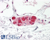 Anti-DLG4 / PSD95 Antibody (aa683-732) IHC-plus LS-B8203
