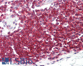 Anti-SEPT9 / Septin 9 Antibody (C-Terminus) IHC-plus LS-B8211