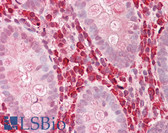 Anti-CHI3L1 / YKL-40 Antibody (aa198-247) IHC-plus LS-B8213