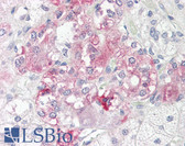 Anti-RIP1 / RALBP1 Antibody (N-Terminus) IHC-plus LS-B8214