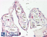 Anti-KERA / Keratocan Antibody (aa196-245) IHC-plus LS-B8216