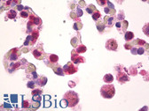 Anti-CLCF1 Antibody IHC-plus LS-B8220