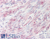 Anti-BABAM1 / HSPC142 Antibody (aa36-85) IHC-plus LS-B8224