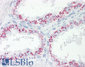 Anti-CPEB3 Antibody (aa324-373) IHC-plus LS-B8227