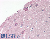 Anti-PAFAH1B1 / LIS1 Antibody (N-Terminus) IHC-plus LS-B8228