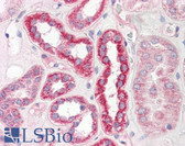 Anti-PLS3 / T Plastin Antibody (aa503-552) IHC-plus LS-B8229