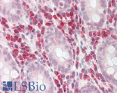 Anti-PDE4D Antibody (aa164-213) IHC-plus LS-B8230