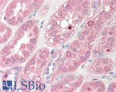 Anti-MSRA Antibody (C-Terminus) IHC-plus LS-B8231