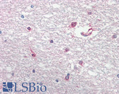 Anti-BCAN / Brevican Antibody (aa539-588) IHC-plus LS-B8232
