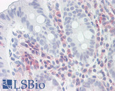 Anti-PSME1 Antibody (aa72-121) IHC-plus LS-B8233