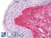 Anti-Collagen V Antibody IHC-plus LS-B8237