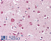 Anti-HSPA8 / HSC70 Antibody IHC-plus LS-B8243