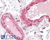 Anti-BIRC2 / cIAP1 Antibody IHC-plus LS-B8247