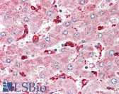 Anti-CETP Antibody (C-Terminus) IHC-plus LS-B8251