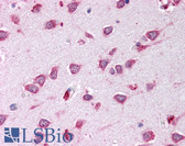 Anti-ARTN / Artemin Antibody (Internal) IHC-plus LS-B234