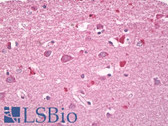 Anti-RHOG / ARHG Antibody (aa112-161) IHC-plus LS-B8255