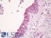 Anti-LIMPII / SCARB2 Antibody (aa25-74) IHC-plus LS-B8260