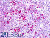 Anti-CBFB Antibody (N-Terminus) IHC-plus LS-B8269
