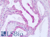 Anti-STK33 Antibody (aa34-83) IHC-plus LS-B8271