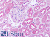 Anti-SH2D4A Antibody (aa145-194) IHC-plus LS-B8272