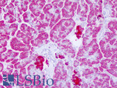 Anti-LYPLAL1 Antibody (C-Terminus) IHC-plus LS-B8274