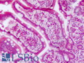 Anti-GSDMA Antibody (aa223-272) IHC-plus LS-B8275