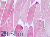 Anti-NDUFAF2 / NDUFA12L Antibody (aa22-71) IHC-plus LS-B8278
