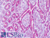 Anti-MRPL12 Antibody (aa87-136) IHC-plus LS-B8280