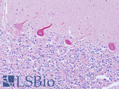 Anti-GMIP Antibody (aa804-853) IHC-plus LS-B8282