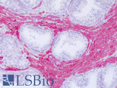 Anti-ACTG2 Antibody (C-Terminus) IHC-plus LS-B8283