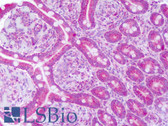 Anti-NT5E / eNT / CD73 Antibody (aa433-482) IHC-plus LS-B8284