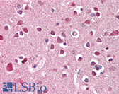 Anti-XAB2 Antibody (C-Terminus) IHC-plus LS-B8287