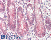 Anti-STAP2 Antibody (C-Terminus) IHC-plus LS-B8288