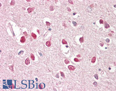 Anti-BAIAP2 / IRSP53 Antibody (Isoform 3) IHC-plus LS-B8289
