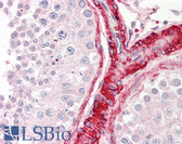 Anti-BAG5 Antibody (N-Terminus) IHC-plus LS-B8290