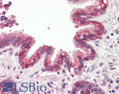 Anti-BRUCE / BIRC6 Antibody (C-Terminus) IHC-plus LS-B8292