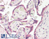 Anti-RNF139 / TRC8 Antibody (C-Terminus) IHC-plus LS-B8293