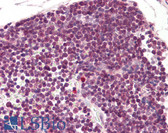 Anti-RAN Antibody (N-Terminus) IHC-plus LS-B8294