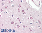 Anti-HAP1 Antibody (Internal) IHC-plus LS-B8296