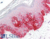 Anti-ATG16L1 / ATG16L Antibody (C-Terminus) IHC-plus LS-B8297