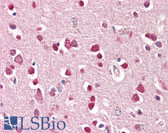 Anti-GRIK1 / GLUR5 Antibody (Internal) IHC-plus LS-B8298