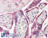 Anti-ESYT1 Antibody (Internal) IHC-plus LS-B8299