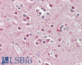 Anti-CHRNB2 Antibody (Internal) IHC-plus LS-B8300