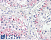 Anti-CPT1C Antibody (Internal) IHC-plus LS-B8301