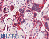Anti-IDS Antibody (Internal) IHC-plus LS-B8302
