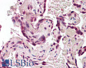 Anti-BAG4 / SODD Antibody (Internal) IHC-plus LS-B8303