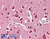 Anti-UNC5H3 / UNC5C Antibody (Internal) IHC-plus LS-B8305