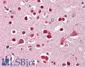 Anti-GRIK5 / KA2 Antibody (C-Terminus) IHC-plus LS-B8306