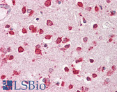 Anti-LIMPII / SCARB2 Antibody (Internal) IHC-plus LS-B8307